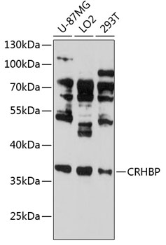 Western blot analysis of extracts of various cell lines using CRHBP Polyclonal Antibody at 1:3000 dilution.