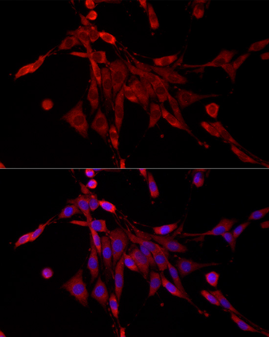 Immunofluorescence analysis of PC-12 cells using PDE4C Polyclonal Antibody at dilution of 1:400 (40x lens).Blue: DAPI for nuclear staining.