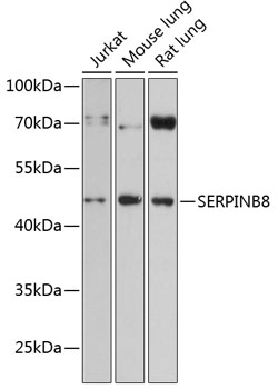 Western blot analysis of extracts of various cell lines using SERPINB8 Polyclonal Antibody at 1:3000 dilution.