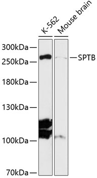 Western blot analysis of extracts of various cell lines using SPTB Polyclonal Antibody at 1:3000 dilution.