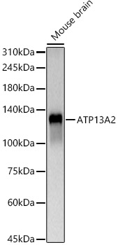 Western blot analysis of Mouse brain using ATP13A2 Polyclonal Antibody at 1:500 dilution.