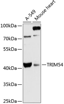 Western blot analysis of extracts of various cell lines using TRIM54 Polyclonal Antibody at 1:3000 dilution.