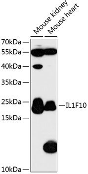 Western blot analysis of extracts of various cell lines using IL1F10 Polyclonal Antibody at 1:3000 dilution.