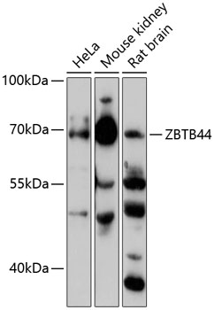 Western blot analysis of extracts of various cell lines using ZBTB44 Polyclonal Antibody at 1:3000 dilution.