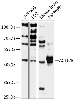 Western blot analysis of extracts of various cell lines using ACTL7B Polyclonal Antibody at 1:3000 dilution.