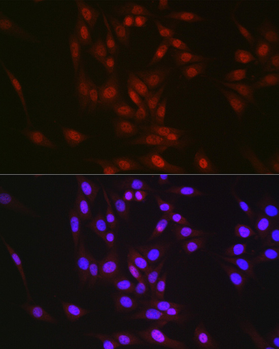 Immunofluorescence analysis of NIH/3T3 cells using RBM14 Polyclonal Antibody at dilution of 1:300 (40x lens). Blue: DAPI for nuclear staining.