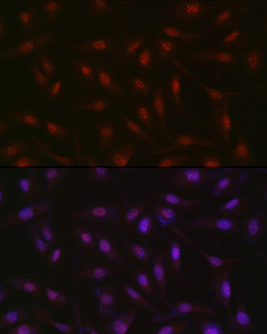 Immunofluorescence analysis of U2OS cells using RBM14 Polyclonal Antibody at dilution of 1:300 (40x lens). Blue: DAPI for nuclear staining.