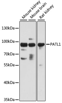 Western blot analysis of extracts of various cell lines using PATL1 Polyclonal Antibody at 1:3000 dilution.