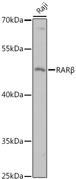 Western blot analysis of extracts of Raji cells using RARβ Polyclonal Antibody at 1:3000 dilution.