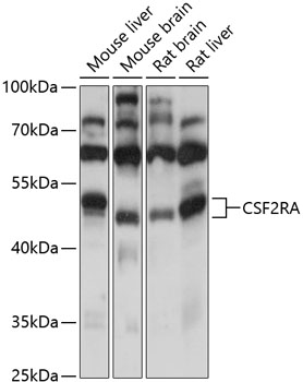 Western blot analysis of extracts of various cell lines using CSF2RA Polyclonal Antibody at 1:500 dilution.