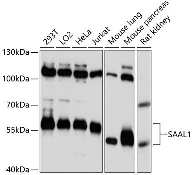 Western blot analysis of extracts of various cell lines using SAAL1 Polyclonal Antibody at 1:3000 dilution.