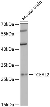 Western blot analysis of extracts of mouse brain using TCEAL2 Polyclonal Antibody at 1:3000 dilution.