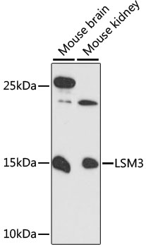 Western blot analysis of extracts of various cell lines using LSM3 Polyclonal Antibody at 1:3000 dilution.