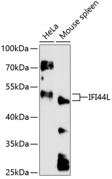 Western blot analysis of extracts of various cell lines using IFI44L Polyclonal Antibody at 1:3000 dilution.