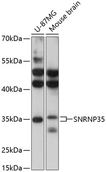 Western blot analysis of extracts of various cell lines using SNRNP35 Polyclonal Antibody at 1:3000 dilution.