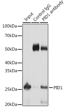 Immunoprecipitation analysis of 25ug extracts of Mouse liver cells using 3ug PID1 Polyclonal Antibody.Western blot was performed from the immunoprecipitate using PID1 Polyclonal Antibody at a dilution of 1:1000.