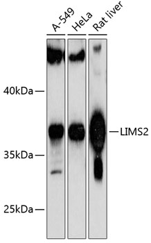 Western blot analysis of extracts of various cell lines using LIMS2 Polyclonal Antibody at 1:1000 dilution.