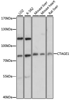 Western blot analysis of extracts of various cell lines using CTAGE1 Polyclonal Antibody at 1:3000 dilution.