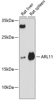 Western blot analysis of extracts of various cell lines using ARL11 Polyclonal Antibody at 1:3000 dilution.