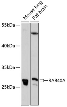 Western blot analysis of extracts of various cell lines using RAB40A Polyclonal Antibody at 1:3000 dilution.