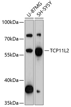 Western blot analysis of extracts of various cell lines using TCP11L2 Polyclonal Antibody at 1:3000 dilution.