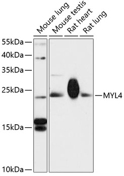 Western blot analysis of extracts of various cell lines using MYL4 Polyclonal Antibody at 1:3000 dilution.