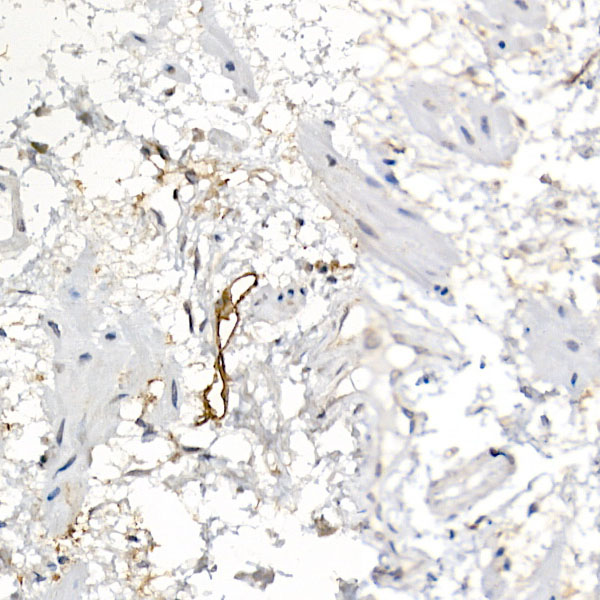 Immunohistochemistry of paraffin-embedded human esophagus using Podoplanin Polyclonal Antibody at dilution of 1:20 (40x lens).Perform high pressure antigen retrieval with 10 mM citrate buffer pH 6.0 before commencing with IHC staining protocol.