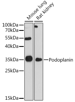 Western blot analysis of extracts of various cell lines using Podoplanin Polyclonal Antibody at 1:1000 dilution.