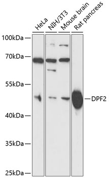 Western blot analysis of extracts of various cell lines using DPF2 Polyclonal Antibody at 1:3000 dilution.