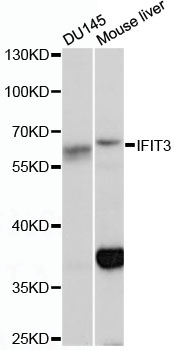 Western blot analysis of extracts of various cell lines using IFIT3 Polyclonal Antibody at 1:1000 dilution.