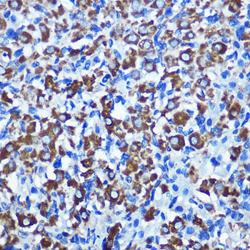 Immunohistochemistry of paraffin-embedded rat ovary using NEK2 Polyclonal Antibody at dilution of 1:100 (40x lens).Perform microwave antigen retrieval with 10 mM PBS buffer pH 7.2 before commencing with IHC staining protocol.