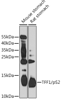 Western blot analysis of extracts of various cell lines using TFF1/pS2 Polyclonal Antibody at 1:1000 dilution.