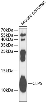 Western blot analysis of extracts of mouse pancreas using CLPS Polyclonal Antibody at 1:1000 dilution.