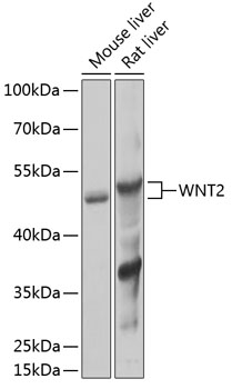 Western blot analysis of extracts of various cell lines using WNT2 Polyclonal Antibody at 1:1000 dilution.