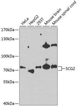 Western blot analysis of extracts of various cell lines using SCG2 Polyclonal Antibody at 1:1000 dilution.