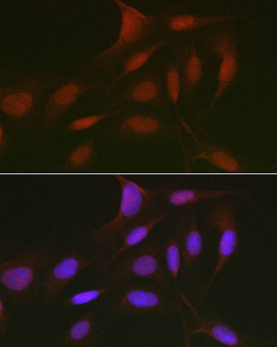 Immunofluorescence analysis of U2OS cells using RBL2 Polyclonal Antibody at dilution of 1:50 (40x lens). Blue: DAPI for nuclear staining.