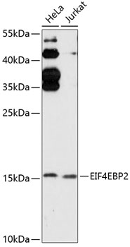 Western blot analysis of extracts of various cell lines using EIF4EBP2 Polyclonal Antibody at 1:3000 dilution.