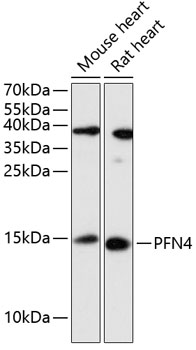 Western blot analysis of extracts of various cell lines using PFN4 Polyclonal Antibody at 1:3000 dilution.