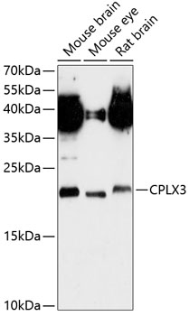 Western blot analysis of extracts of various cell lines using CPLX3 Polyclonal Antibody at 1:3000 dilution.