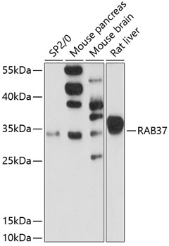 Western blot analysis of extracts of various cell lines using RAB37 Polyclonal Antibody at 1:3000 dilution.