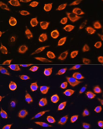 Immunofluorescence analysis of L929 cells using RND1 Polyclonal Antibody at dilution of 1:100. Blue: DAPI for nuclear staining.