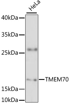 Western blot analysis of extracts of HeLa cells using TMEM70 Polyclonal Antibody at 1:3000 dilution.