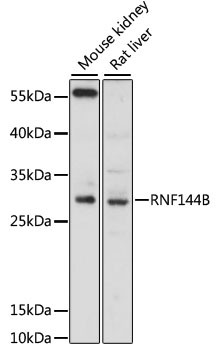 Western blot analysis of extracts of various cell lines using RNF144B Polyclonal Antibody at 1:3000 dilution.