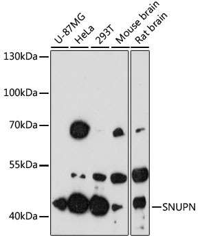 Western blot analysis of extracts of various cell lines using SNUPN Polyclonal Antibody at 1:3000 dilution.