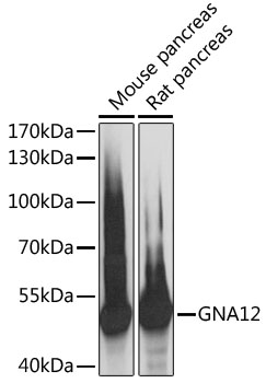 Western blot analysis of extracts of various cell lines using GNA12 Polyclonal Antibody at 1:3000 dilution.