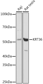 Western blot analysis of extracts of various cell lines using KRT36 Polyclonal Antibody at 1:1000 dilution.