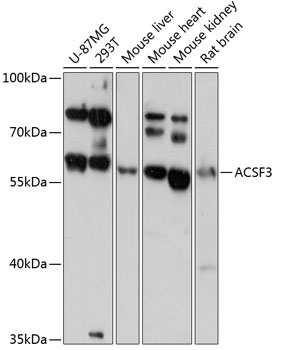 Western blot analysis of extracts of various cell lines using ACSF3 Polyclonal Antibody at 1:3000 dilution.