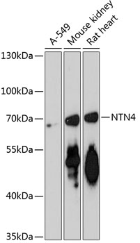 Western blot analysis of extracts of various cell lines using NTN4 Polyclonal Antibody at 1:3000 dilution.