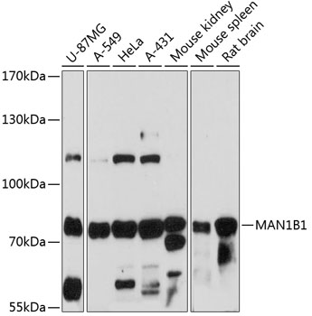 Western blot analysis of extracts of various cell lines using MAN1B1 Polyclonal Antibody at 1:3000 dilution.