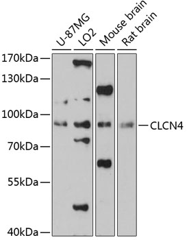 Western blot analysis of extracts of various cell lines using CLCN4 Polyclonal Antibody at 1:3000 dilution.